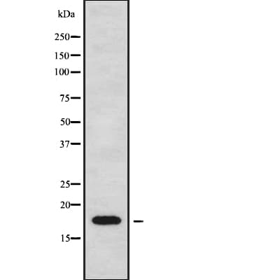 CKLF Antibody