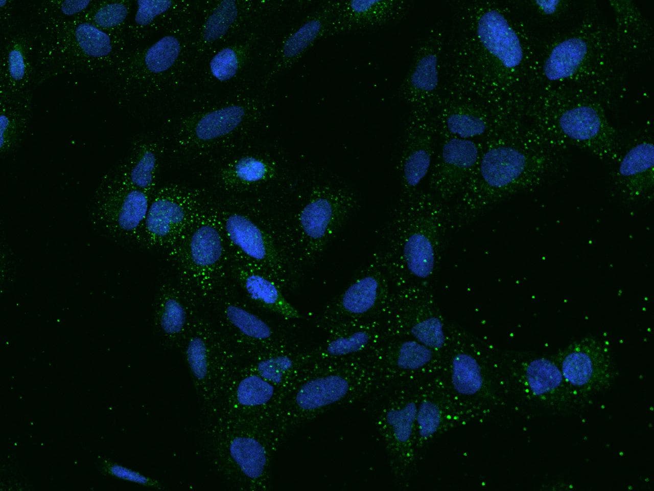 Polyclonal Rabbit anti-Human SMIM5 Antibody (IF)