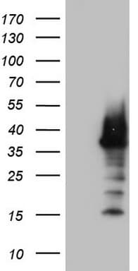 NKX3-1 Antibody (clone OTI1C2)