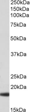 HP / Haptoglobin Antibody (aa51-63)