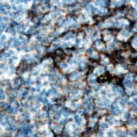 CMTM8 Antibody (Internal)