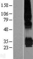 PPAP2C Protein (Over-Expression Lysate Myc-DDK (Flag))