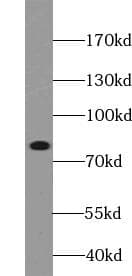 BTK Antibody (phospho-Tyr223)