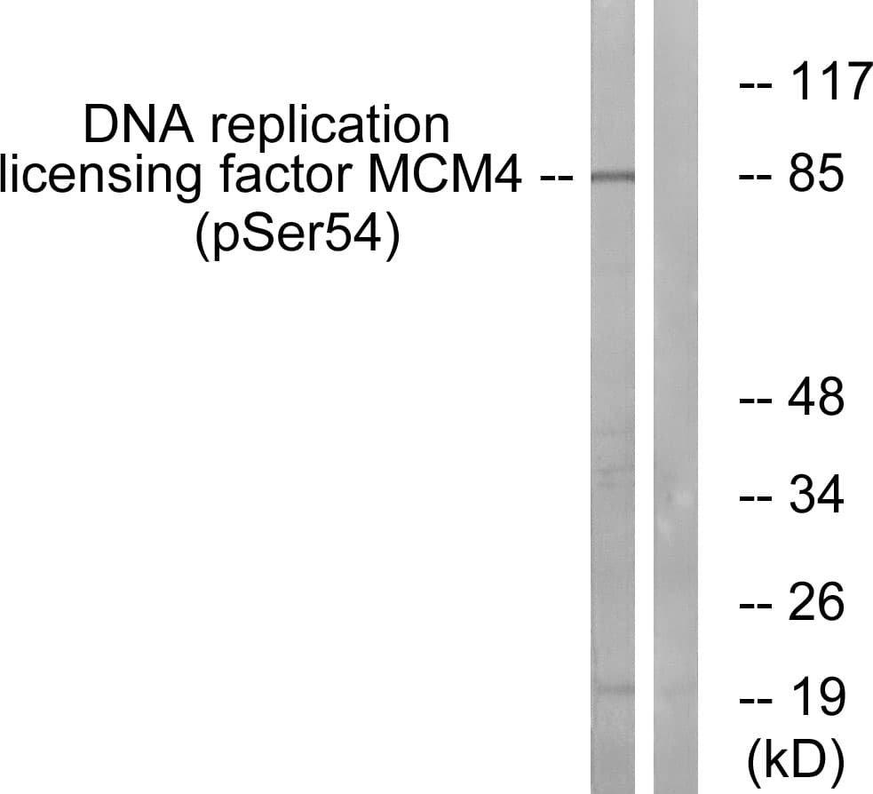 MCM4 Antibody (phospho-Ser54)