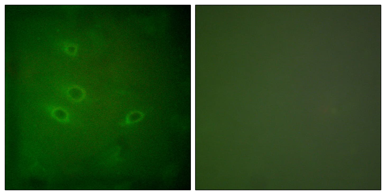 Polyclonal Rabbit anti-Human CARD6 Antibody (aa1-50, IHC, IF, WB)