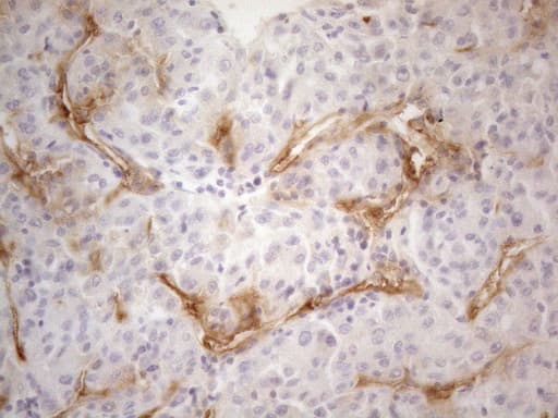 PODXL / Podocalyxin Antibody (aa32-461, clone OTI8D6, Carrier-free)