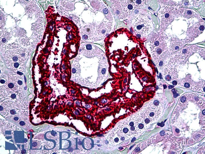 IHC-plus™ INHA / Inhibin Alpha Antibody