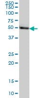 Monoclonal Mouse anti-Human TADA2B Antibody (clone 1C8, WB)