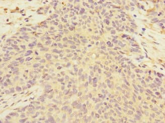 Polyclonal Rabbit anti-Human FMO2 Antibody (IHC)