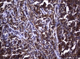 VILIP / VSNL1 Antibody (aa2-191, clone OTI1F7)