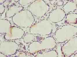 ALAS2 Antibody