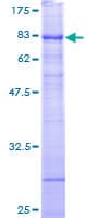 Human RRP9 Protein (Recombinant GST)