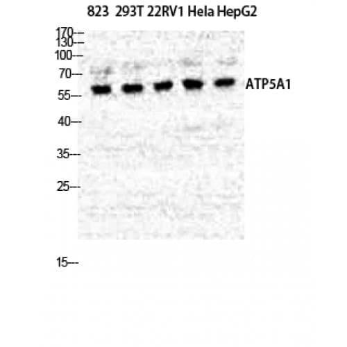 Polyclonal Rabbit anti-Human ATP5A1 / ATP Synthase Alpha Antibody (180-260 aa, Internal, IHC, WB)