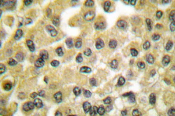 MCL1 / MCL 1 Antibody (Ser121)