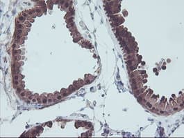 ACY1 / Aminoacylase 1 Antibody (clone OTI2F1)