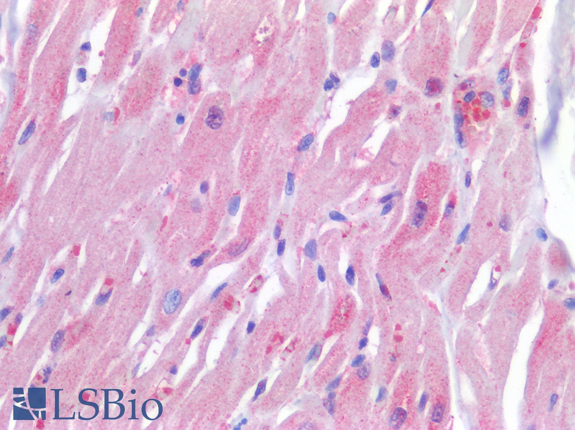 IHC-plus™ Polyclonal Rabbit anti-Human TP53 / p53 Antibody (IHC)