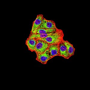 Monoclonal Mouse anti-Human IDH1 / IDH Antibody (clone 7G8A1, IHC, WB)