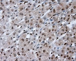 TLDC1 / KIAA1609 Antibody (clone OTI12B1)