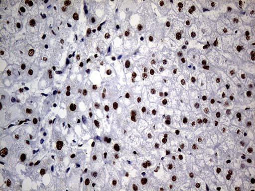 HNRNPH1 / hnRNP H Antibody (clone OTI4F10)