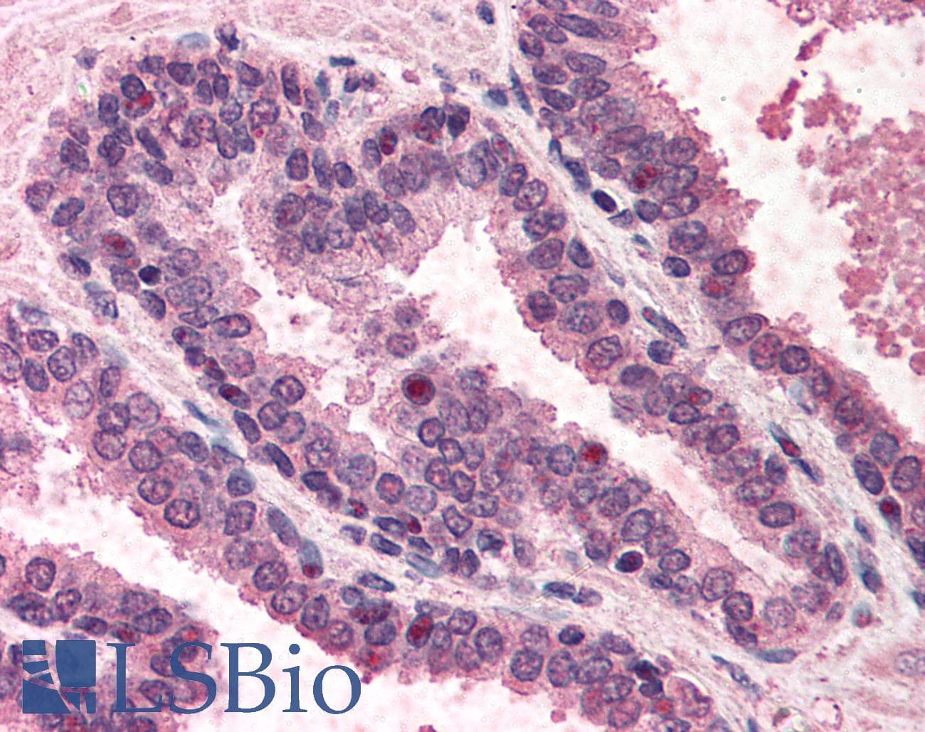 IHC-plus™ POLK / DNA Polymerase Kappa Antibody