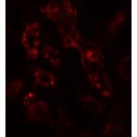 ARF6 Antibody