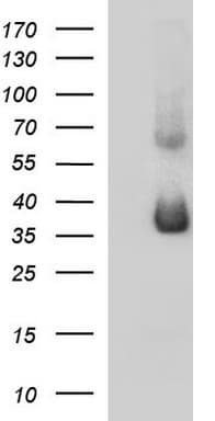 SCAMP2 Antibody (clone OTI2F1)