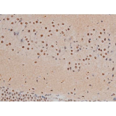 AP-1 / JUND Antibody (phospho-Ser255)