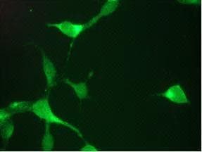 PathPlus™ Monoclonal Mouse-Balb/c anti-Human KLK3 / PSA Antibody (clone 1A7, IHC)