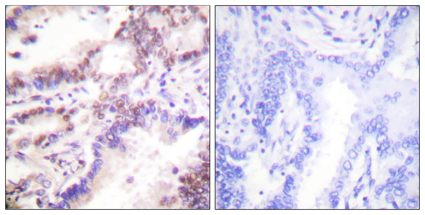 RBBP8 / CTIP Antibody (aa293-342)