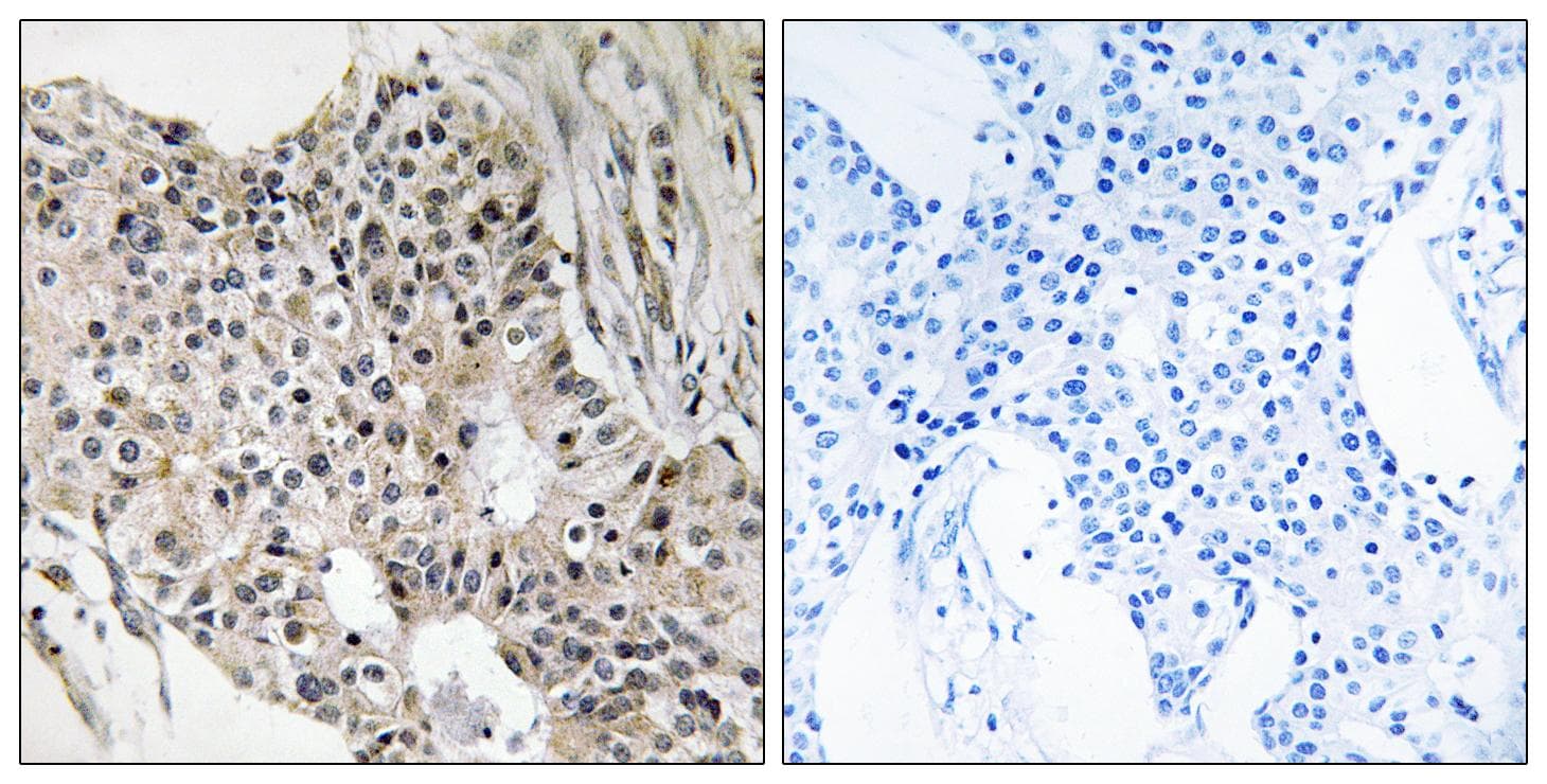 Polyclonal Rabbit anti-Human UEVLD Antibody (IHC, WB)
