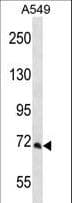 Polyclonal Rabbit anti-Human PCCA Antibody (aa362-390, IHC, WB)