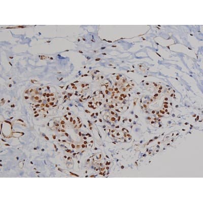 Polyclonal Rabbit anti-Human ZAP70 Antibody (phospho-Tyr319, IHC, IF, WB)
