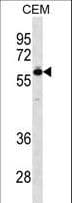 TBX5 Antibody (aa1-30)