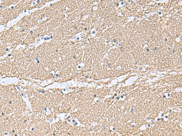 Polyclonal Rabbit anti-Human TAGLN3 / Neuronal Protein 22 Antibody (IHC)