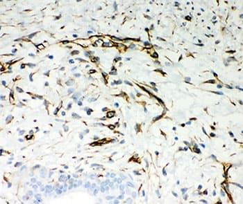 Vimentin Antibody (aa435-465)