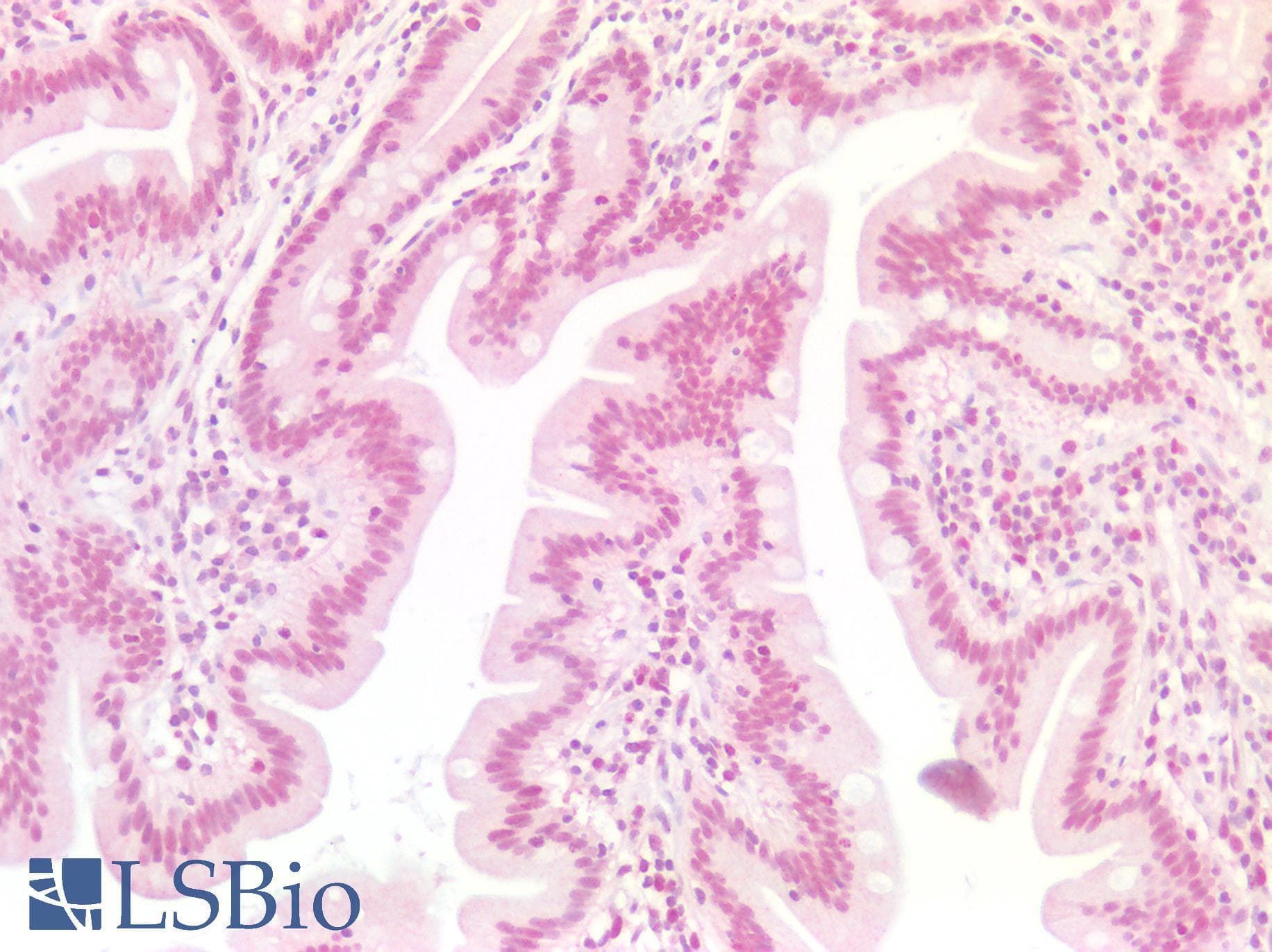 PathPlus™ EP300 / p300 Antibody (aa1-50)