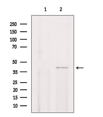 Polyclonal Rabbit anti-Human CHST13 Antibody (IHC, IF, WB)