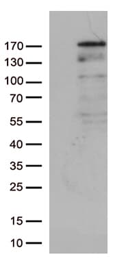 NEDD4 Antibody (aa160-460, clone OTI5F8)