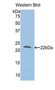 TPT1 / TCTP Antibody (aa1-172)