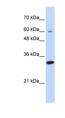 LRRC57 Antibody (N-Terminus)
