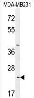 IHC-plus™ SYCE2 Antibody (aa1-30)