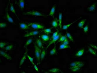 PRKCB / PKC-Beta Antibody