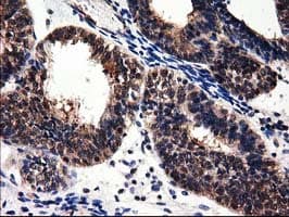 ADSL / Adenylosuccinate Lyase Antibody (clone OTI2D10)
