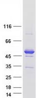 Human ANKS1B Protein (Recombinant Myc-DDK (Flag))