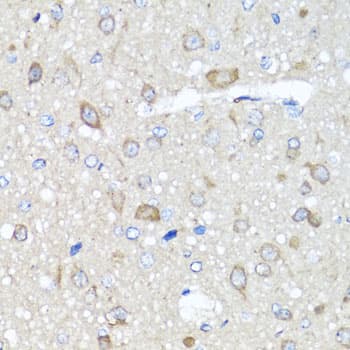 PRKAG1 / AMPK Gamma 1 Antibody
