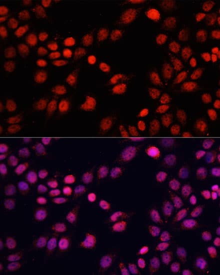 RBFOX3 / NEUN Antibody