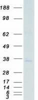 Human PRKY Protein (Recombinant Myc-DDK (Flag))