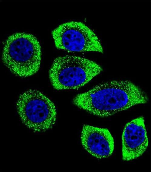 PIP5KL1 Antibody (aa57-86)
