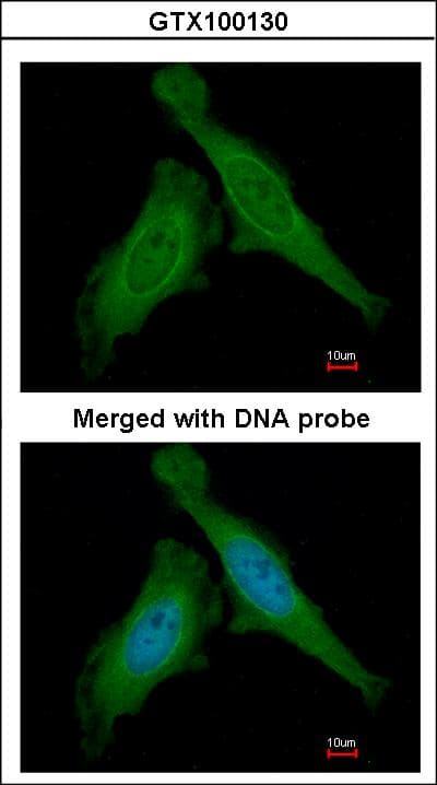 Polyclonal Rabbit anti-Human DDB1 Antibody (aa749-1140, IHC, WB)