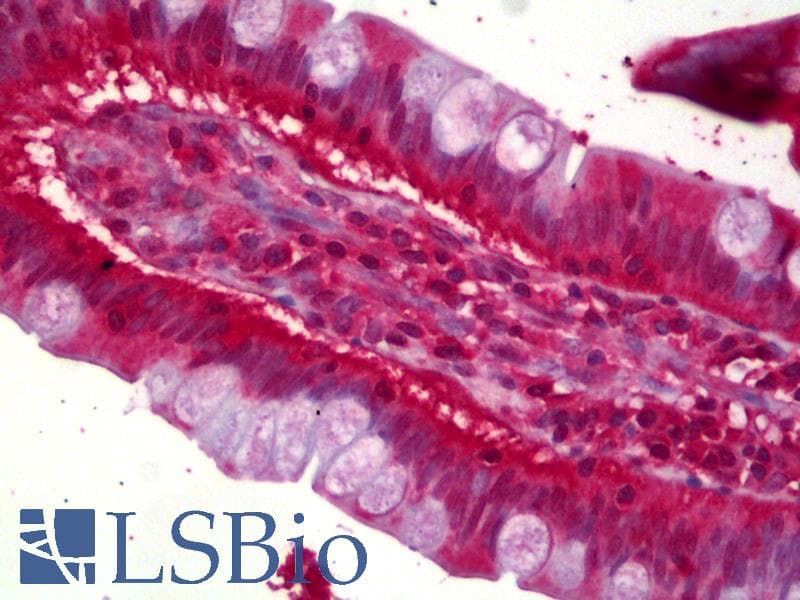 IHC-plus™ Polyclonal Rabbit anti-Human ACAT1 Antibody (IHC, WB)